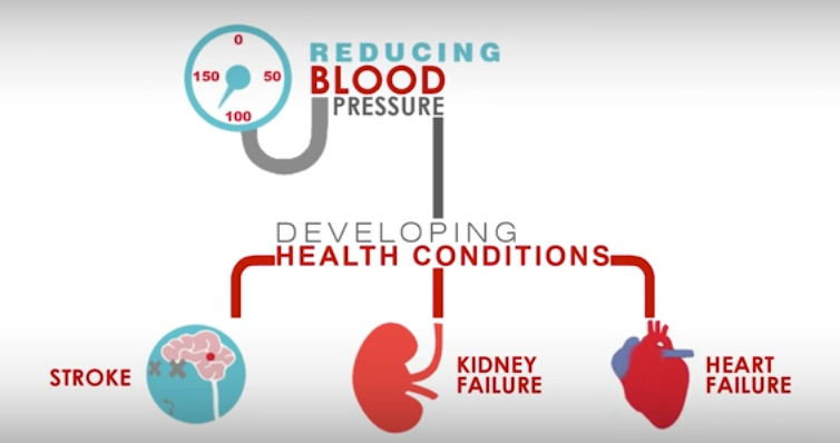 Managing high blood pressure